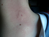 Record depasit la intepaturile albinelor in 2012 1 Miere Săbăduș P1110570 Miere Săbăduș