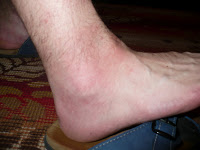 Record depasit la intepaturile albinelor in 2012 2 Miere Săbăduș P1120417 Miere Săbăduș